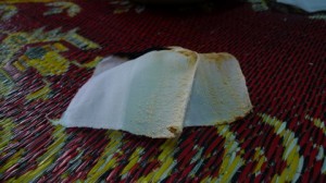 KOTORAN yang ‘dikeluarkan’ melalui rawatan dijalankan.