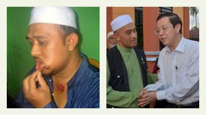 (Gambar kiri), ROSLAN Rahim @ Hussain menunjukkan kecederaan yang dialami.  (Gambar kanan), ROSLAN  Rahim @ Hussain bersalaman dengan Ketua Menteri pada Majlis Buka                           Puasa di Masjid Sungai Burung di sini baru-baru ini. 