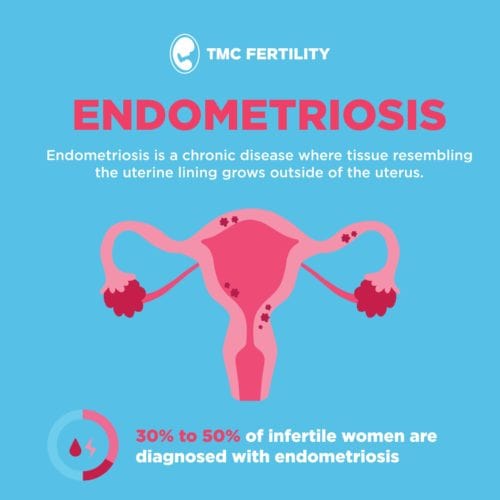 endometioris 1